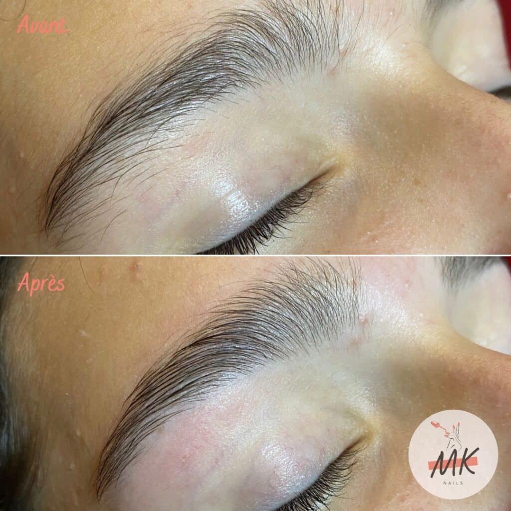 Restructuration sourcils